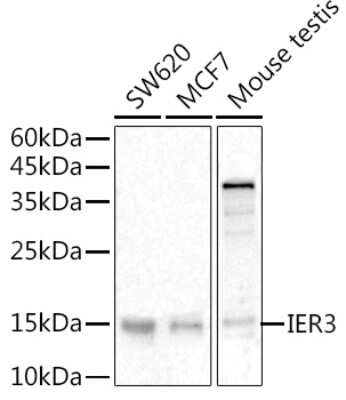 Western Blot: IER3 Antibody [NBP3-03948] - Western blot analysis of extracts of various cell lines, using IER3 antibody (NBP3-03948) at 1:500 dilution. Secondary antibody: HRP Goat Anti-Rabbit IgG (H+L) at 1:10000 dilution. Lysates/proteins: 25ug per lane. Blocking buffer: 3% nonfat dry milk in TBST. Detection: ECL Enhanced Kit. Exposure time: 180s.